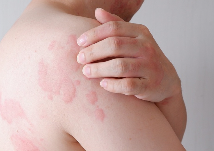 Giữ Nhà Khô Thoáng – Sống Khỏe Mỗi Ngày Với Máy Hút Ẩm Xiaomi